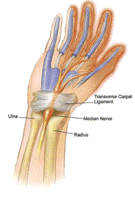 Compressive Neuropathies are frequent in Diabetes