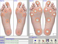 Biothesiometry