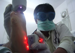 Laser Treatment