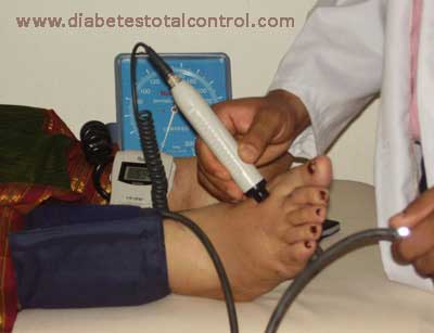 Vascular - Doppler ABI