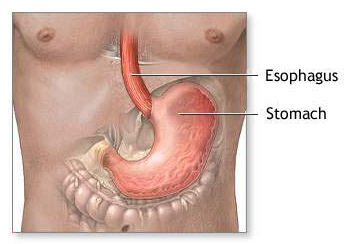 Diabetic Gastropathy due to High Glucose levels